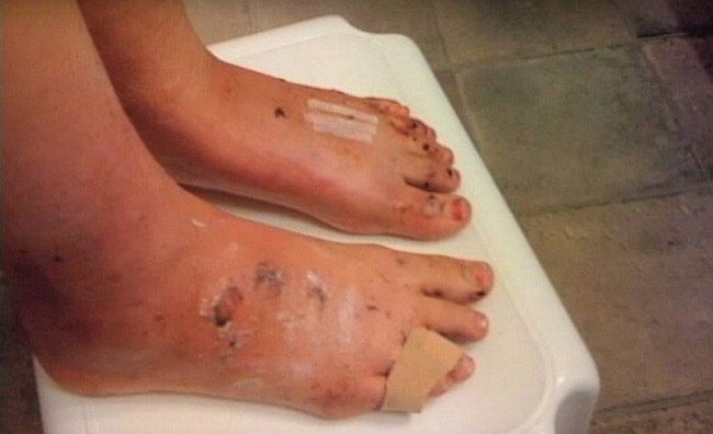 Bethany’s feet were hard pressed Bethany’s feet were hard pressed